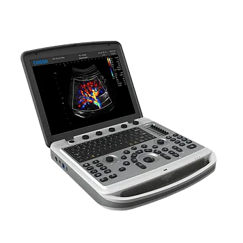 УЗИ аппарат Chison SonoBook 6 портативный