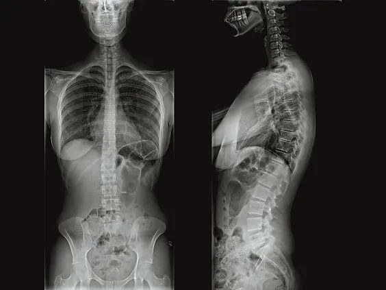 Клинические изображения GE Healthcare Optima XR220amx палатный цифровой рентгеновский аппарат