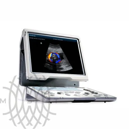УЗИ аппарат Mindray DP-50 Color портативный