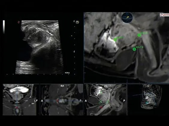 Клинические изображения УЗИ аппарат Esaote MyLab Twice