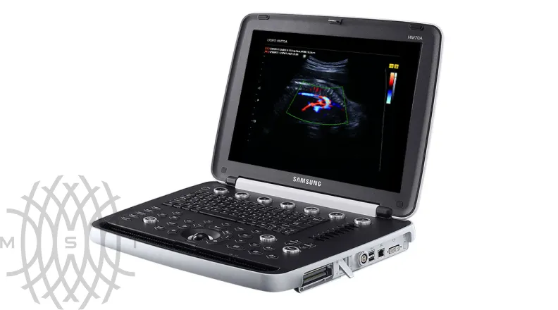 Samsung Medison HM70 EVO УЗИ аппарат портативный