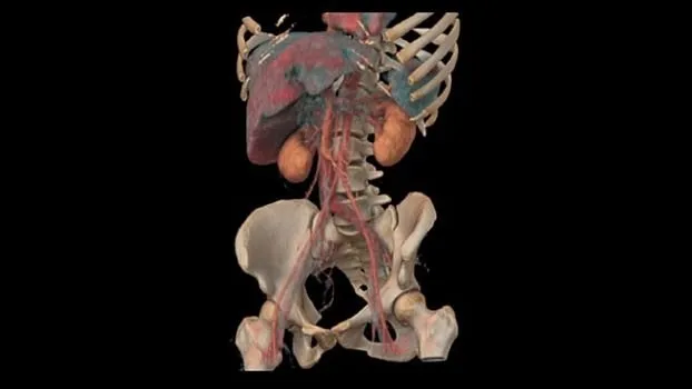 Клинические изображения Компьютерный томограф GE Revolution Ascend