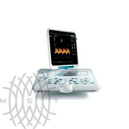 Портативный УЗИ аппарат Esaote MyLab Alpha