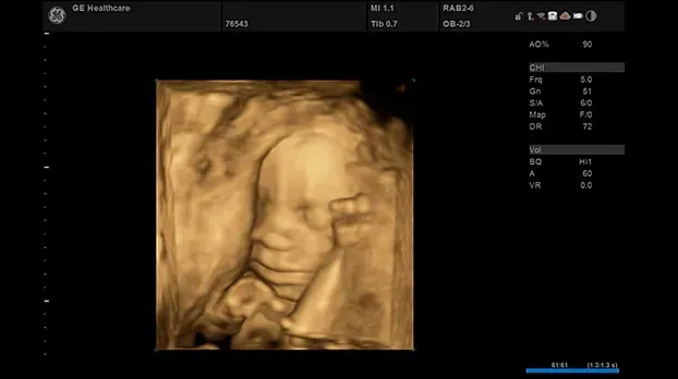 Клинические изображения УЗИ аппарат GE Healthcare Versana Essential 