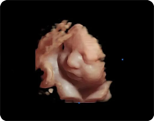 Клинические изображения Chison Qbit 6 ультразвуковой аппарат