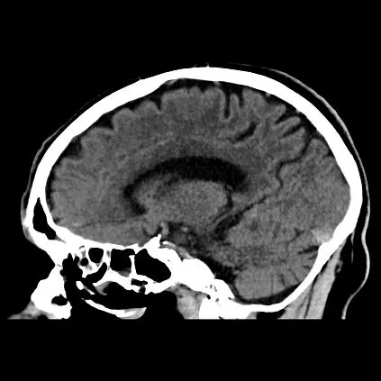 Клинические изображения Компьютерный томограф Canon Aquilion Prime SP