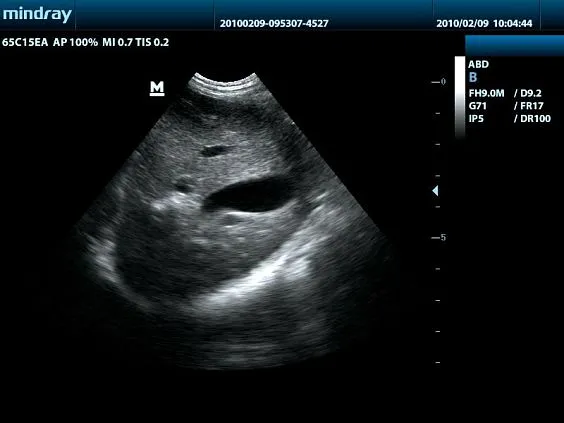 Клинические изображения УЗИ аппарат Mindray DP-50 Vet ветеринарный портативный