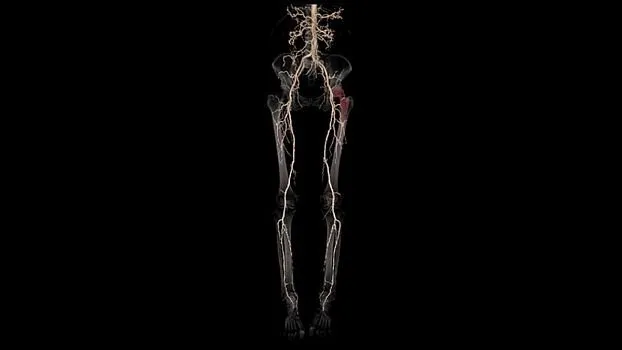 Клинические изображения Компьютерный томограф GE Revolution Ascend