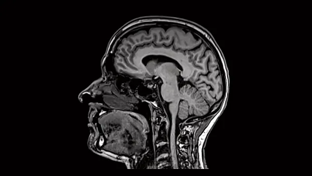 Клинические изображения МРТ аппарат Siemens Magnetom Sola 1,5T