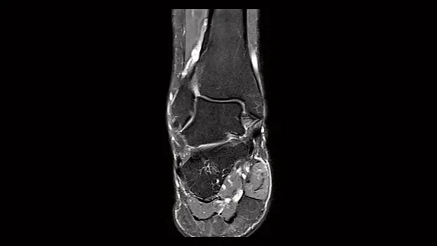 Клинические изображения МРТ аппарат Siemens Magnetom Sola 1,5T