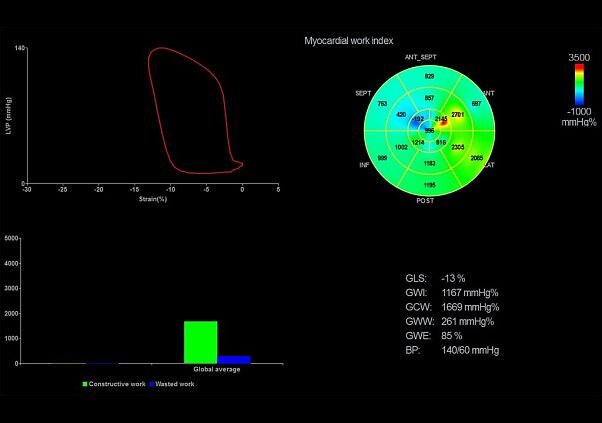 GE Vivid E95 аппарат ультразвуковой