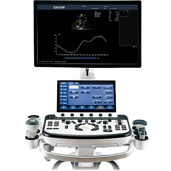 Ультразвуковой аппарат Chison XBit 90